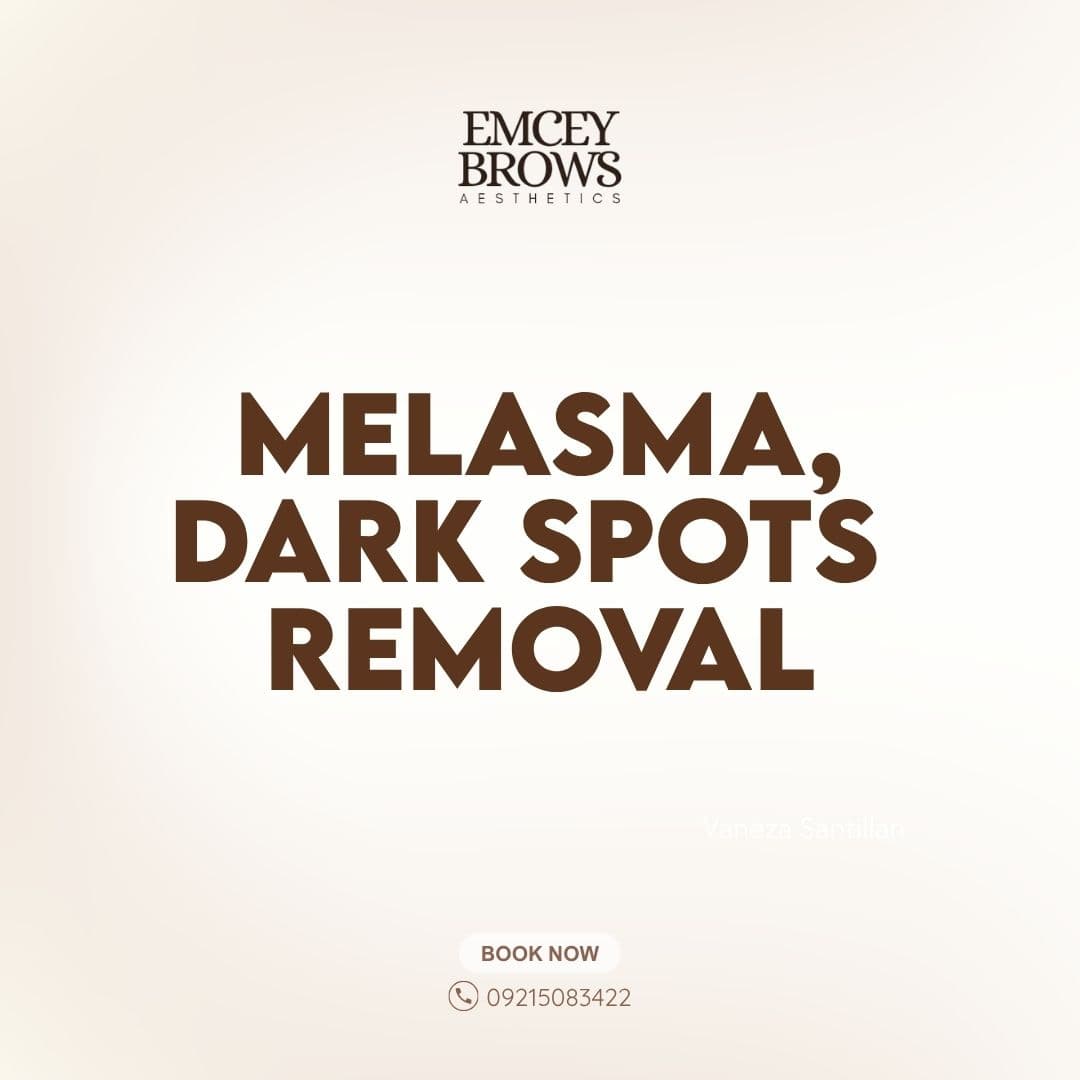MELASMA/DARK SPORTS REMOVAL by Emcey Brows — Imus, Cavite