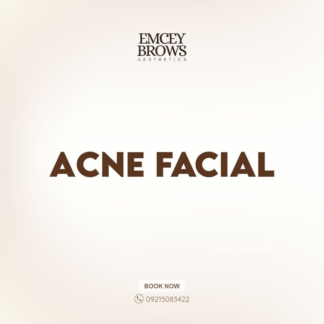 ACNE FACIAL by Emcey Brows — Imus, Cavite